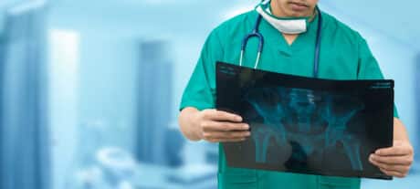 Orthopedic Radiology Equipment Funding